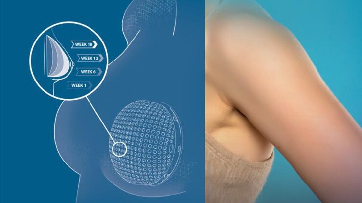 lattice Dassault Systemes