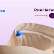 Telefónica mantiene previsiones 2025 con crecimiento en España y Brasil pese a pérdidas