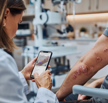 Inteligencia Artificial - Dermatología