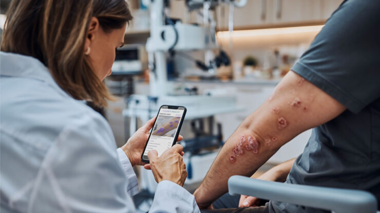 Inteligencia Artificial - Dermatología