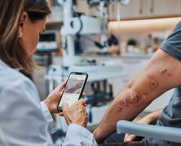 Inteligencia Artificial - Dermatología