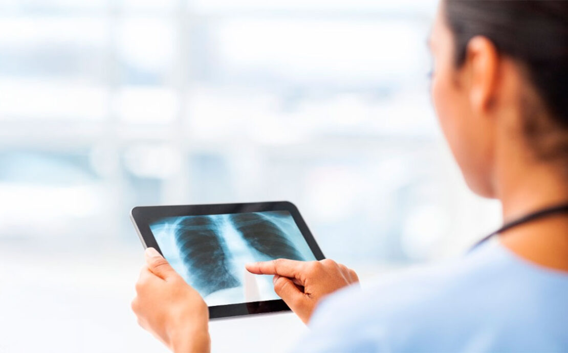 Radiología Inteligencia Artificial