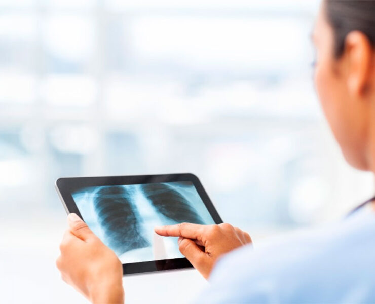 Radiología Inteligencia Artificial