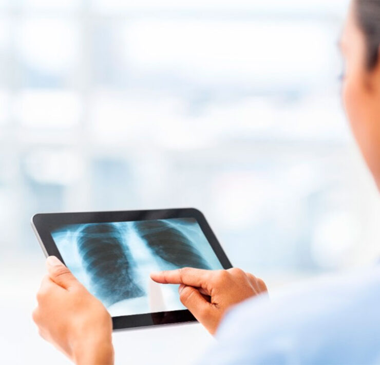 Radiología Inteligencia Artificial